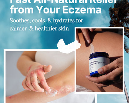 The Ocean Healed My Eczema™  - Soothing Cream