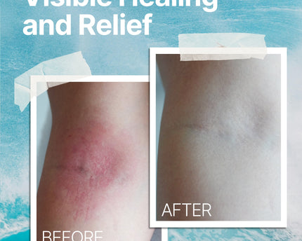 The Ocean Healed My Eczema™  - Soothing Cream