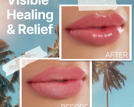 The Ocean Healed My Eczema™ - Mongongo Lip Balm