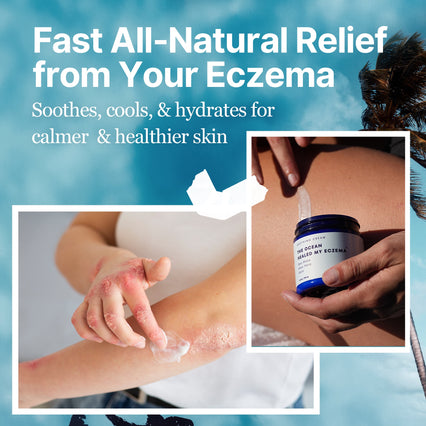 The Ocean Healed My Eczema - Soothing Cream – HealedByTheOcean