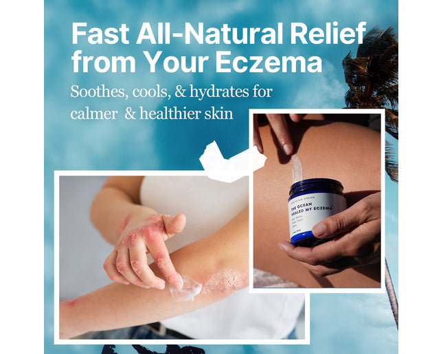 The Ocean Healed My Eczema™  - Soothing Cream