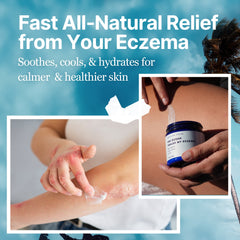 The Ocean Healed My Eczema™  - Soothing Cream