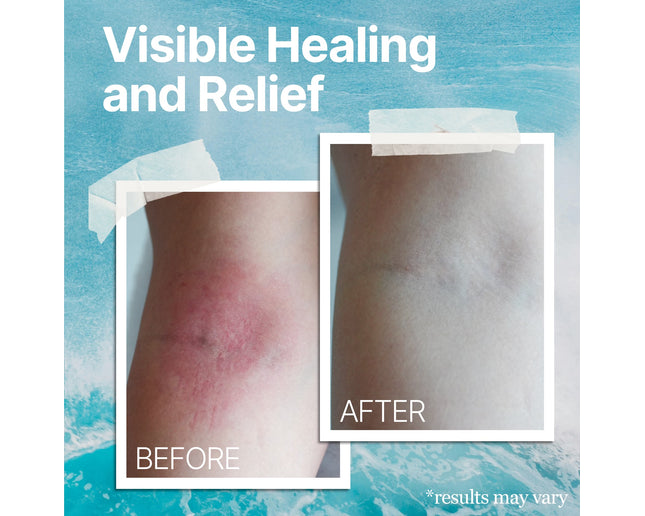 The Ocean Healed My Eczema™  - Soothing Cream