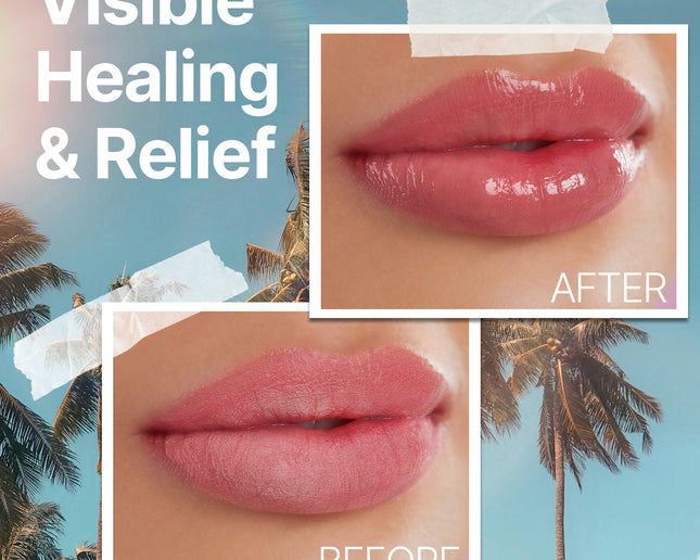 The Ocean Healed My Eczema™ - Mongongo Lip Balm